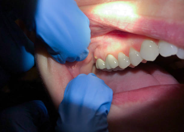 Best Emergency Root Canal Therapy in Glen Allen, VA