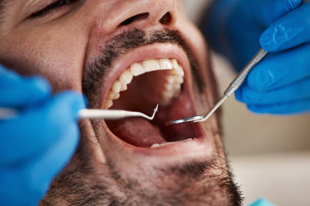 Best Emergency Root Canal Therapy in Glen Allen, VA